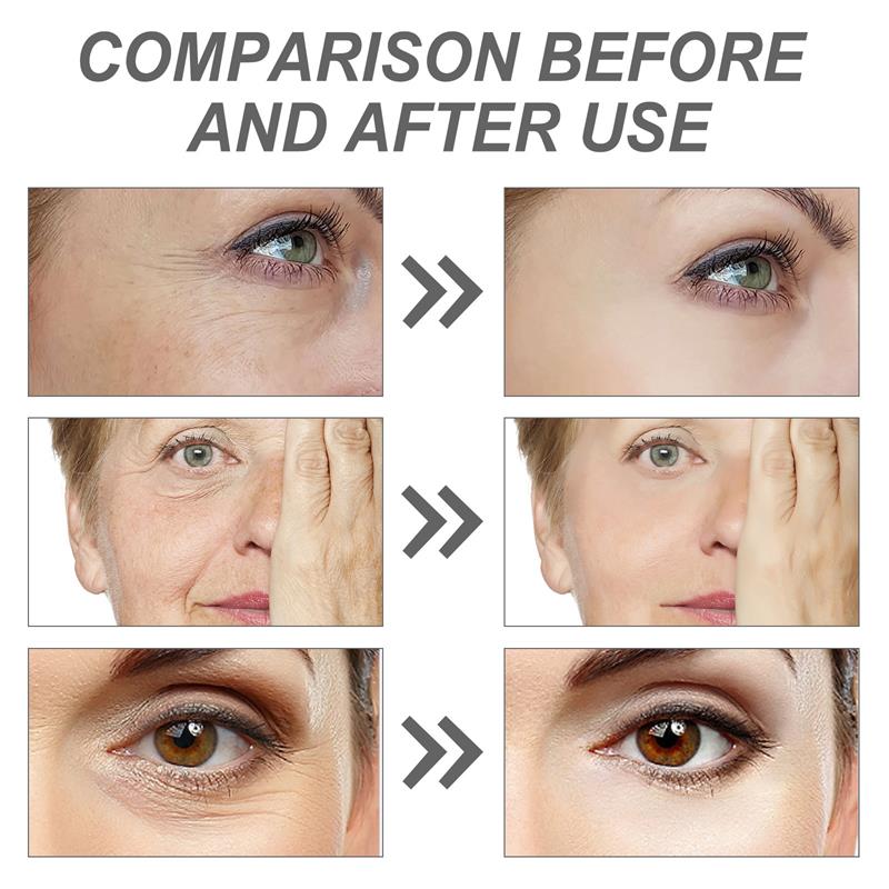 Serum do twarzy z retinolem re – The Ordinary Serum Hyaluronic Acid recenzja i cena